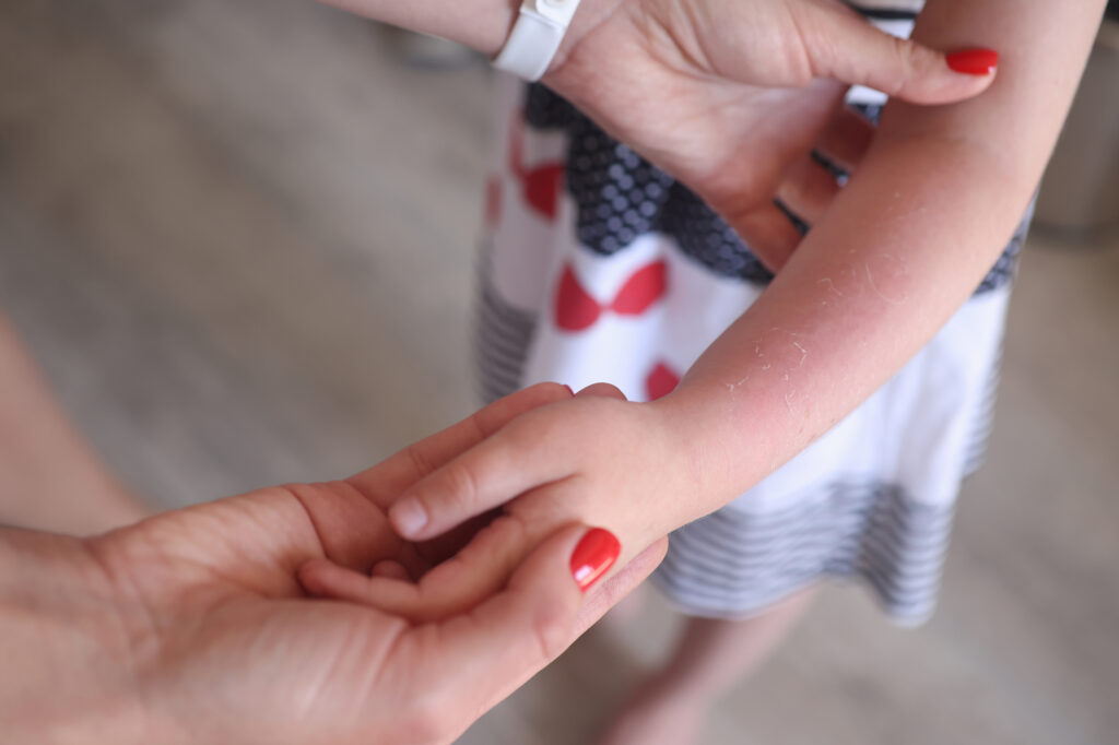 子供の腕が赤くなっていてそれを確かめるように優しく腕を掴んでいる大人の手